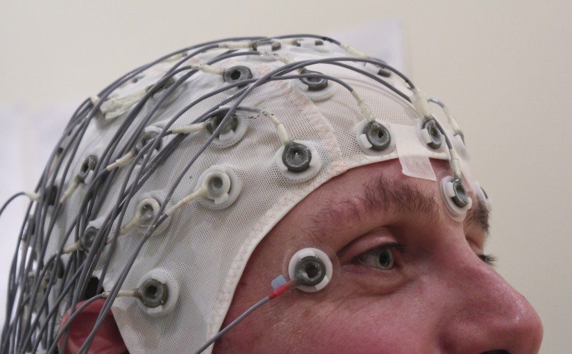 “EEG Recording Cap” by Colin licensed under CC by 2.0