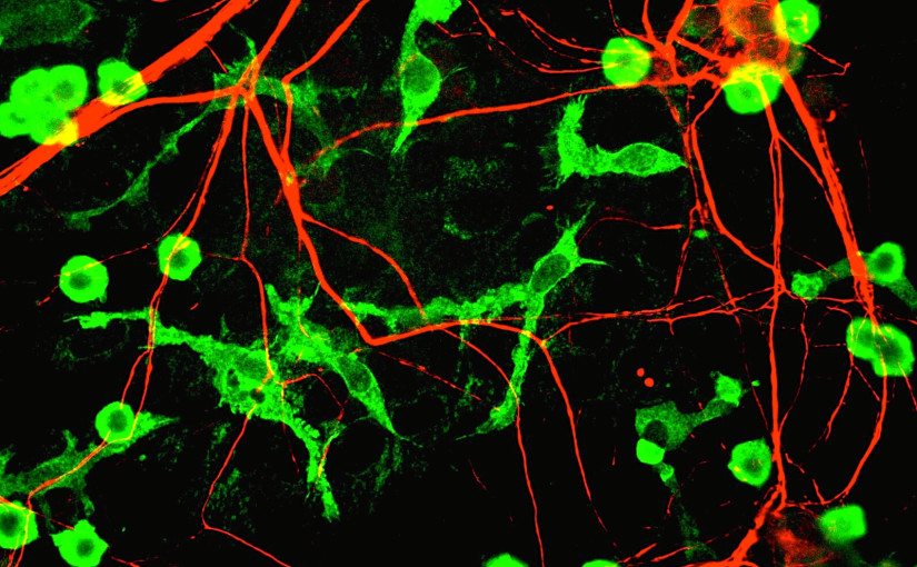 Microglia and Neurons by GerryShaw CC BY 3.0 https://commons.wikimedia.org/wiki/File:Microglia_and_neurons.jpg